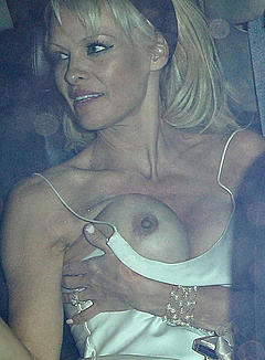 Pamela Anderson boob slip at the Chateau Marmont