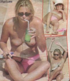 Philippa Forrester topless on a beach paparazzi photo