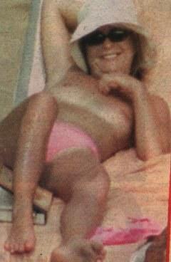 Phillipa Forrester sunbathing topless
